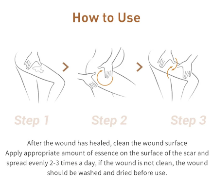 ACNE SCAR REMOVAL CREAM