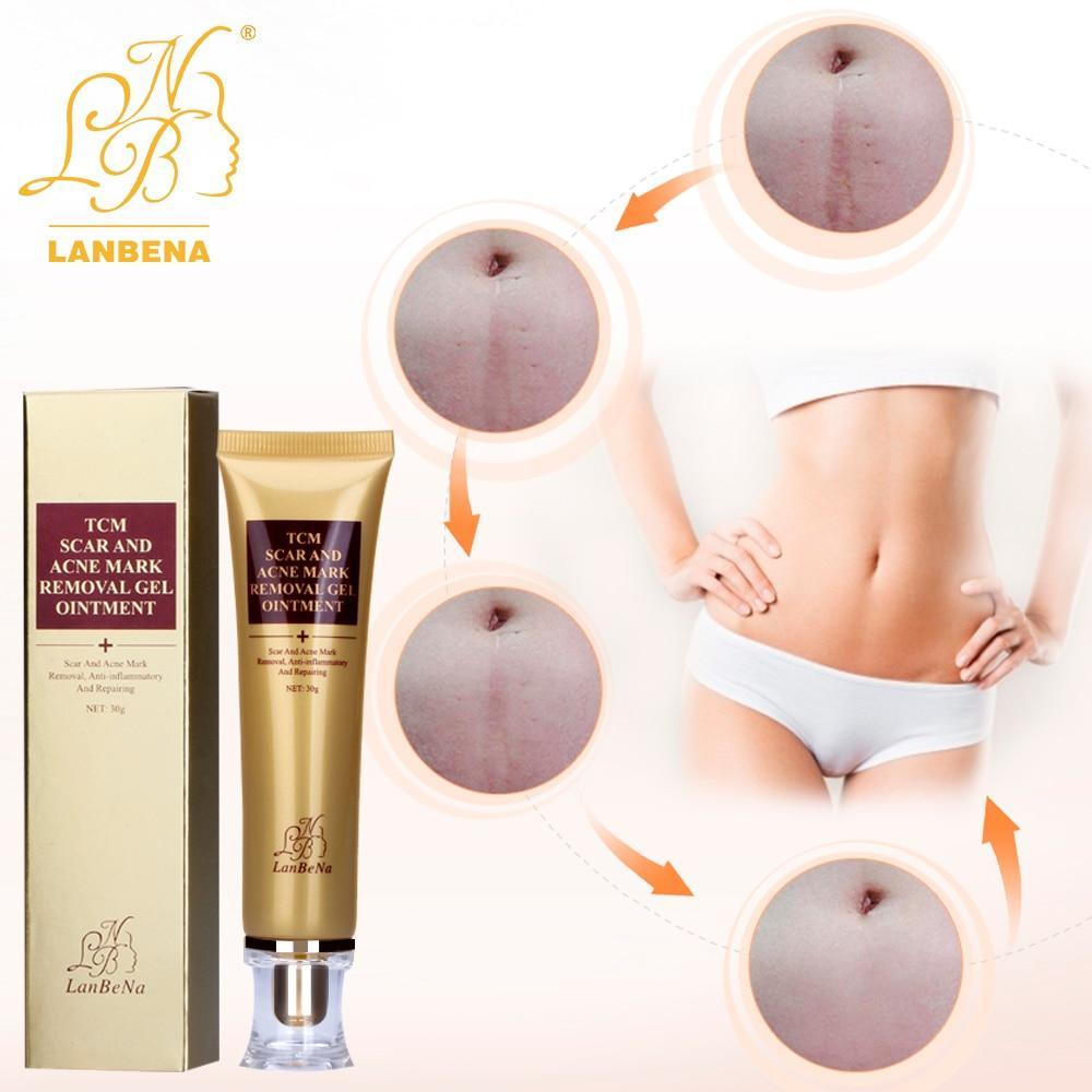 ACNE SCAR REMOVAL CREAM